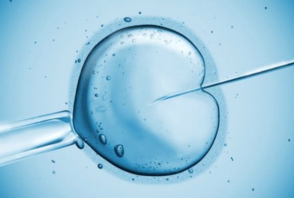 ivf