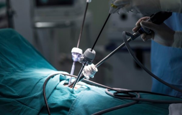 Get Maximum Fertility Benefits From Minimal Access Surgery - Dr. Abayomi Ajayi
