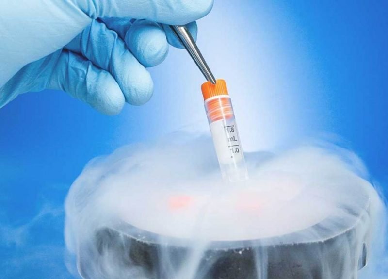 egg freezing